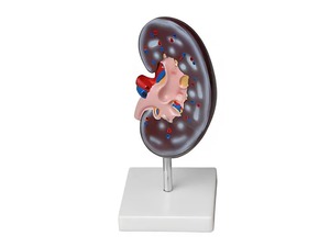 Модель почки в разрезе - fgospostavki.ru - Салехард