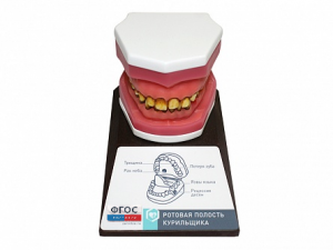 Демонстрационная модель "Ротовая полость курильщика" - fgospostavki.ru - Салехард