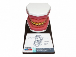 Демонстрационная модель "Ротовая полость курильщика" - fgospostavki.ru - Салехард